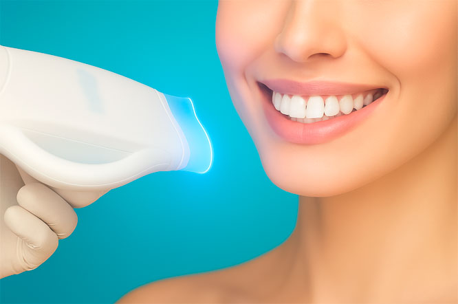 Отбеливание зубов ZOOM4 30000р.